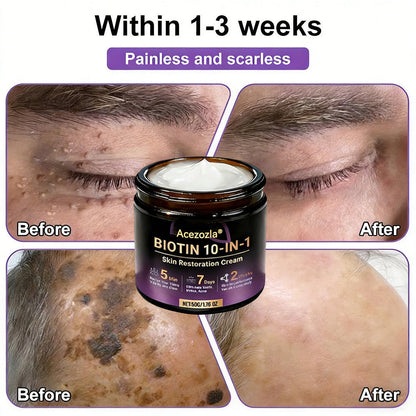 Made and Shipped from USA ✨Acezozla® Biotin 10-in-1 Skin Restoration Cream 🍀