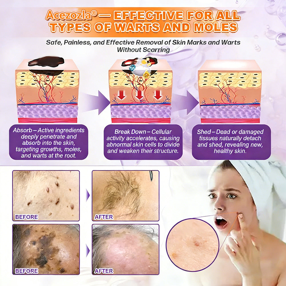Made and Shipped from USA ✨Acezozla® Biotin 10-in-1 Skin Restoration Cream 🍀