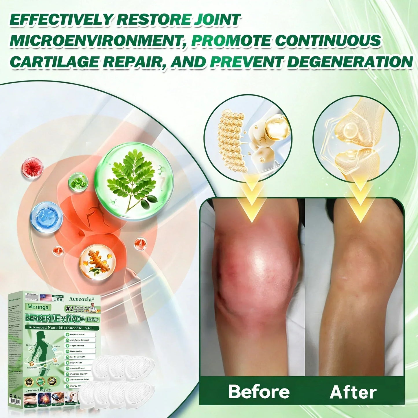 𝐎𝐟𝐟𝐢𝐜𝐢𝐚𝐥 𝐔𝐒 𝐒𝐭𝐨𝐫𝐞 | Acezozla® Moringa · Berberine × NAD+ 𝟏𝟎-𝐢𝐧-𝟏 𝐀𝐝𝐯𝐚𝐧𝐜𝐞𝐝 𝐍𝐚𝐧𝐨 𝐌𝐢𝐜𝐫𝐨𝐧𝐞𝐞𝐝𝐥𝐞 𝐏𝐚𝐭𝐜𝐡 — 𝐎𝐧𝐜𝐞 𝐃𝐚𝐢𝐥𝐲, 𝐕𝐢𝐬𝐢𝐛𝐥𝐞 𝐑𝐞𝐬𝐮𝐥𝐭𝐬 𝐢𝐧 𝟕 𝐃𝐚𝐲𝐬🔥