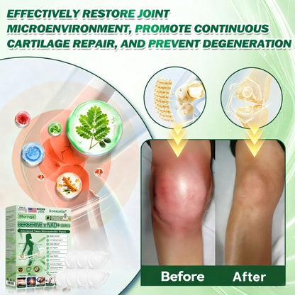 𝐎𝐟𝐟𝐢𝐜𝐢𝐚𝐥 𝐔𝐒 𝐒𝐭𝐨𝐫𝐞 | Acezozla® Moringa · Berberine × NAD+ 𝟏𝟎-𝐢𝐧-𝟏 𝐀𝐝𝐯𝐚𝐧𝐜𝐞𝐝 𝐍𝐚𝐧𝐨 𝐌𝐢𝐜𝐫𝐨𝐧𝐞𝐞𝐝𝐥𝐞 𝐏𝐚𝐭𝐜𝐡 — 𝐎𝐧𝐜𝐞 𝐃𝐚𝐢𝐥𝐲, 𝐕𝐢𝐬𝐢𝐛𝐥𝐞 𝐑𝐞𝐬𝐮𝐥𝐭𝐬 𝐢𝐧 𝟕 𝐃𝐚𝐲𝐬🔥