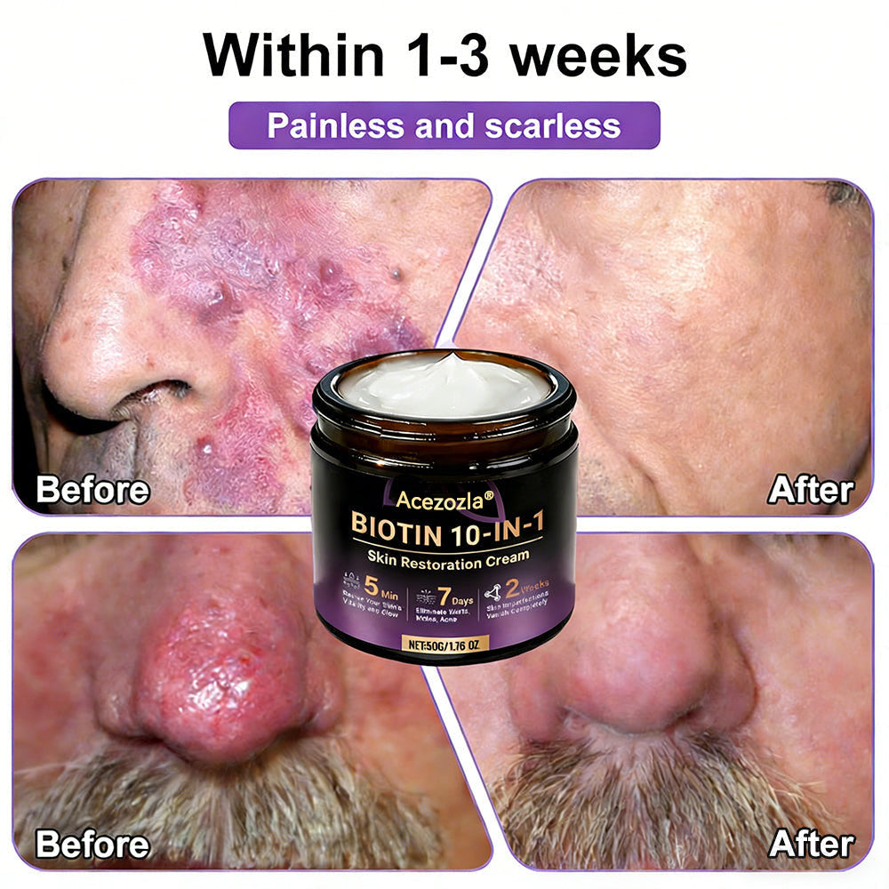 Made and Shipped from USA ✨Acezozla® Biotin 10-in-1 Skin Restoration Cream 🍀