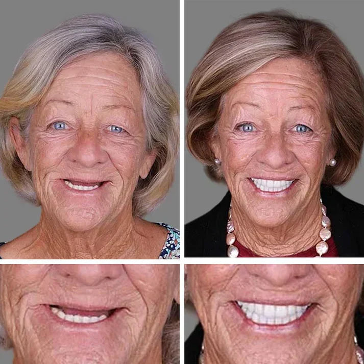 🏆Ends Today: 70% OFF!  🏆2026 Bestselling Product🦷 Fit for a Fresh Smile, Say Goodbye to Wearing Discomfort!🌎